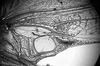 Eriolus duplidentis Naskrecki, 2000: male mirror. (Otu).