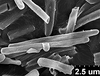 Brochosomes: AG63 | Costa Rica, Turrialba | [no date] | Schild & Burgdorf | USNM. (Observation).