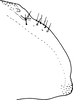 Pygofer, lateral view on Edwardsiana commissuralis (Stål, 1858): Pygofer, lateral view. (Observation).