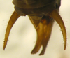 CollectionObject 1476144; 7f1c841b-e43b-4a4a-8528-5065deb643d9: male abdominal apex, dorsal view (holotype). (CollectionObject).