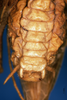 CollectionObject 1505408; a98b5c8e-6c7f-4abc-bc71-a626929d323d: male abdomen, ventral view. (CollectionObject).