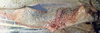 CollectionObject 1517362; f40b1305-ba3f-4e00-984b-641e20b86941: male, left stridulatory area (syntype or lectotype). (CollectionObject).