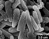Brochosomes on Cuerna arida Oman & Beamer, 1944: CR173 | U.S.A., Arizona, Sta. Catalina Mts. | 7/15/1950 | KSEM. (Observation).