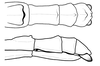 CollectionObject 1596257; 9dfcb0ca-1af0-4198-8a27-0d52024f92dc: copyright NKUM Nankai. female: end of abdomen (holotype). (CollectionObject).