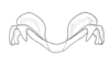 Dichroplus democraticus (Blanchard, 1851): Fig. 15. epiphallus, cephalic view. (Otu).