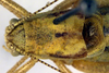 CollectionObject 1500688; 44345cff-a63d-4662-828b-58ed4226af6a: male pronotum, dorsal view (holotype). (CollectionObject).