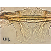 Abdomen, sternal apodemes, ventral view on Bretega linnavuorii Stiller, 2017: Abdomen, sternal apodemes, ventral view. (Observation).