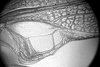 Erioloides latiscobinus Naskrecki & Cohn, 2000: male mirror. (Otu).