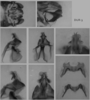 Melanoplus stupefactus (Scudder, 1876): male genitalia. (Otu).
