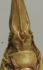CollectionObject 1535136; b141e4c8-66fe-4a7e-bd82-0067d2df359b: female subgenital plate (holotype). (CollectionObject).