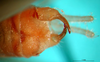 CollectionObject 1502476; 7c344548-1a7e-4e26-bc00-4e61cede82a1: male cerci. (CollectionObject).