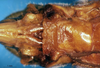 CollectionObject 1567528; 524900d0-55bb-4f01-9caf-a937c36cda13: female subgenital plate (allotype). (CollectionObject).
