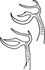 Aedeagus, lateral view on Edwardsiana ulmiphagus Wilson & Claridge, 1999: Aedeagus, lateral view. (Observation).