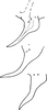 Anal tube processes: Anal tube process. (Observation).
