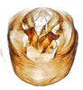 Pygofer, ventral view: !! display not done !! on Pissonotus frontalis (Crawford, 1914): (Observation).