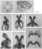 Melanoplus angustipennis (Dodge, 1877): male genitalia. (Otu).