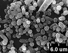 Brochosomes: CR775 | U.S.A., Montana, Jefferson Co., Homestake, R. Rakitov [#04-49], 19-V-2004 | INHS. (Observation).