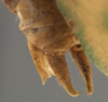 CollectionObject 1505826; 46aae46f-8650-4ca8-9029-155fc2717a03: male cerci (holotype of Amblycorypha tepaneca). (CollectionObject).