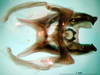 CollectionObject 1581114; 09f74000-3fb8-4392-97ac-7e66b3d1de48: phallic complex, dorsal view (paratype). (CollectionObject).