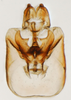 Pygofer, ventral view on Delphacodes lappae Beamer, 1947: (Observation).