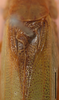 CollectionObject 1586786; 3611040b-9cb9-4b7c-b2b1-ff4ff370fce1: male, stridulatory area, scale bar 2 mm. (CollectionObject).