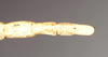 CollectionObject 1558002; NHMUK(SF IMPORT DUPLICATE) 844908, 0cfc66bd-3b25-4a1e-b2d1-f8ea4f367555: copyright Natural History Museum, London. female: end of abdomen, dorsal view of synonym Gratidia turca (holotype). (CollectionObject).