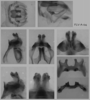 male genitalia. Depicts Melanoplus flabellatus (Scudder, 1878), an Otu.