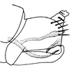 Pygofer, lateral view: Pygofer, lateral view. (Observation).