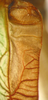 CollectionObject 1475679; ef147de6-945b-48e7-8582-95547db27a17: male left stridulatory area enlarged (holotype). (CollectionObject).