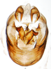 Pygofer, ventral view: !! display not done !! on Pissonotus frontalis (Crawford, 1914): (Observation).