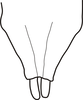 Dissonulichen (Dissonulichen) simplicipes simplicipes (Brunner von Wattenwyl, 1878): reproduced with permission. male dubgenital plate. (Otu).