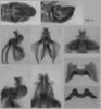 Melanoplus borealis (Fieber, 1853): male genitalia. (Otu).