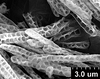 Brochosomes: !! display not done !! on Pseudophera Melichar, 1924: PP22 | Colom[bia] | C. F. Baker | USNM. (Observation).