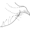 Pygofer appendages: !! display not done !! on Dziwneono alfa Dworakowska, 1993: Pygofer dorsal appendage. (Observation).