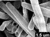 Brochosomes: AG63 | Costa Rica, Turrialba | [no date] | Schild & Burgdorf | USNM. (Observation).