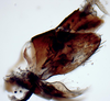 Pygofer, lateral view: !! display not done !! on Scaphytopius elegans (Van Duzee, 1890): Ohio State U. (Observation).