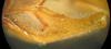 Kuwayamaea sapporensis Matsumura & Shiraki, 1908: male subgenital plate, lateral view. (Otu).