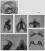 Melanoplus puer (Scudder, 1878): male genitalia. (Otu).