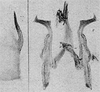 Pygofer lobe, aedeagus, connective, and styli Depicts Other, an Observation.