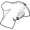 Pygofer, lateral view on Edwardsiana commissuralis (Stål, 1858): Pygofer, lateral view. (Observation).