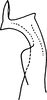Stylus on Erythridula similalis (Ross & DeLong, 1953): Stylus. (Observation).
