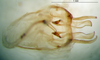 CollectionObject 1500759; 99e6c6e6-b70c-4df8-a157-40b8cd6e318e: phallic complex, dorsal view (holotype). (CollectionObject).