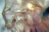 CollectionObject 1537805; accae54a-d8bb-4979-88d1-d6ed859e7ad2: male epiphallus (paratype). (CollectionObject).
