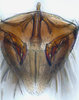 Subgenital plate: (Observation).