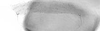 Forewing.: Hairs on eighth abdominal tergite of A. pomi. (Observation).