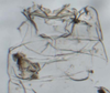 Abdomen, sternal apodemes, ventral view: (Observation).