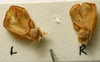 male stridulatory apparatus (holotype of Hetrodes pallidus). Depicts CollectionObject 1516905; b0fcdbb7-9869-4b64-9a2b-bcecb371c6b9, a CollectionObject.