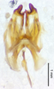 CollectionObject 1523744; 3fac1c77-325b-4392-b4ee-76d2554f09a3: male genitalia, dorsal view (holotype). (CollectionObject).