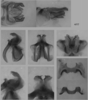 Melanoplus femurnigrum Scudder, 1899: male genitalia. (Otu).