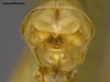 CollectionObject 2189003; 3e92da30-72d7-4127-a757-5a992b930552, ZUFMS ORT00844: Male postabdomen, axial view. (CollectionObject).